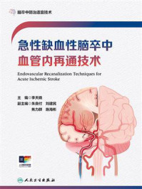 《急性缺血性脑卒中血管内再通技术》-李天晓